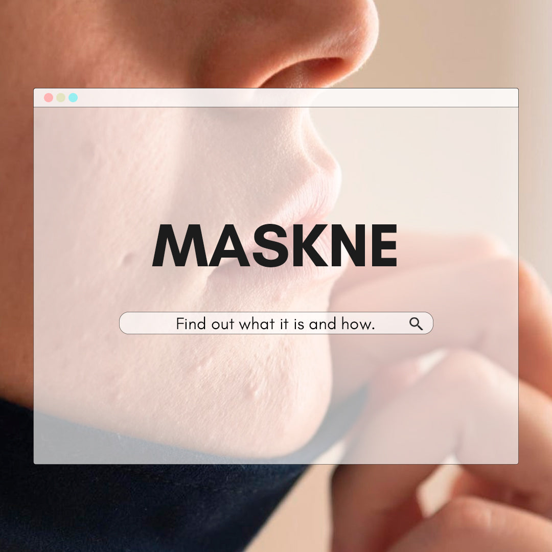 What's Maskne and How to Prevent/Treat Maskne