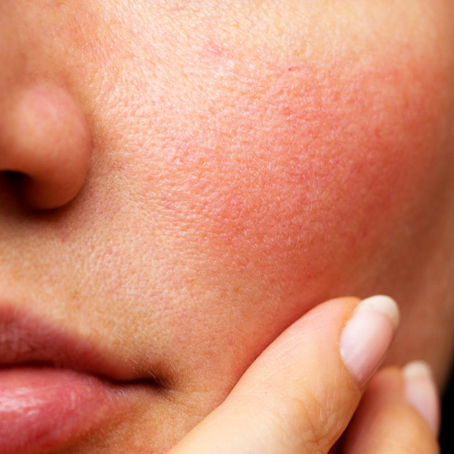 How Do I Know If I Have Sensitive or Sensitized Skin?